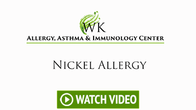 Nickel Allergy